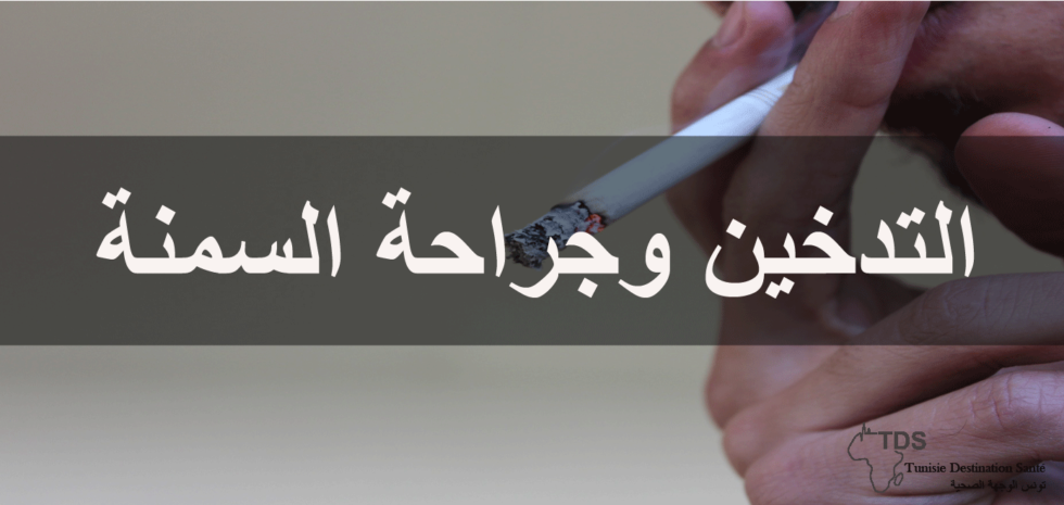 التدخين و جراحة السمنة